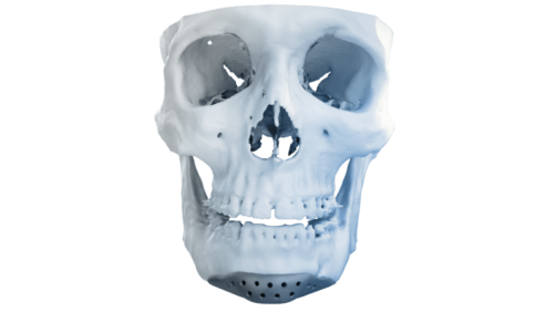 p10-Cosmetic Implant (2)-min