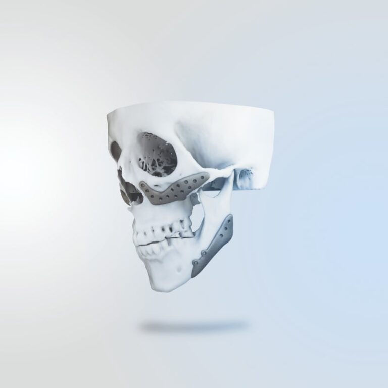 p9-Cosmetic Implant (1)-min