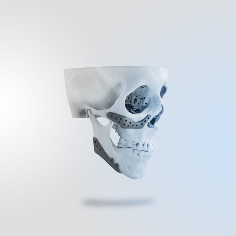 p9-Cosmetic Implant (2)-min