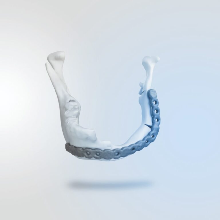 project1-Patient Specific Implants (1)-min