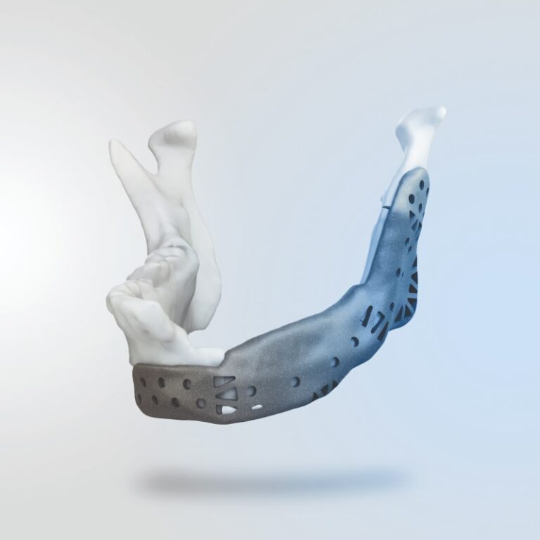 project1-Patient Specific Implants (3)-min