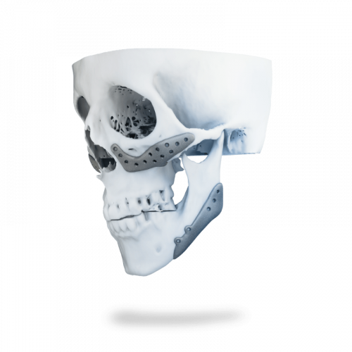 پروتزهای زیبایی