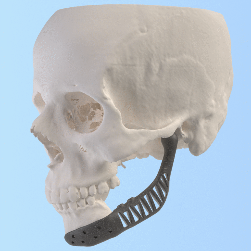 مقدمه: نقش ایمپلنت‌های شخصی‌سازی شده در بهبود کیفیت زندگی 