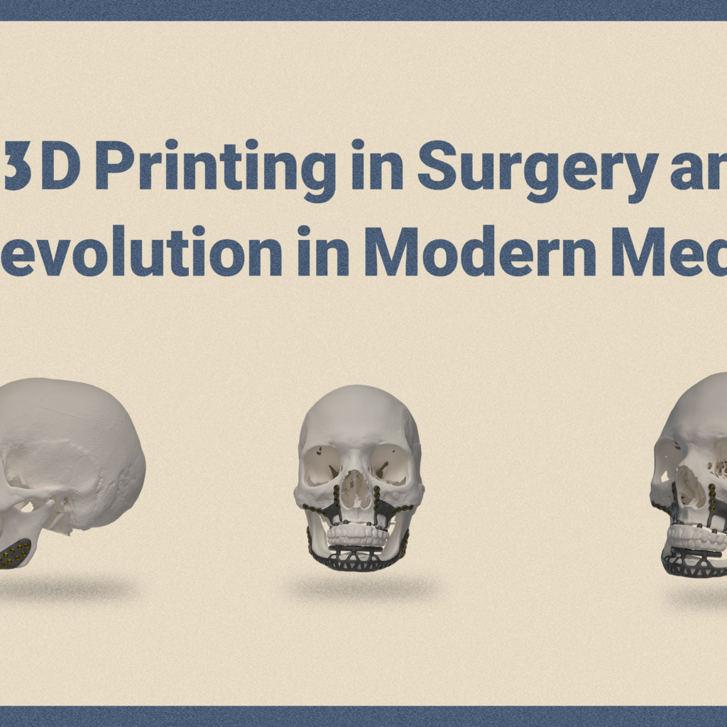 3D Printing in Surgery and A Revolution in Modern Medicine