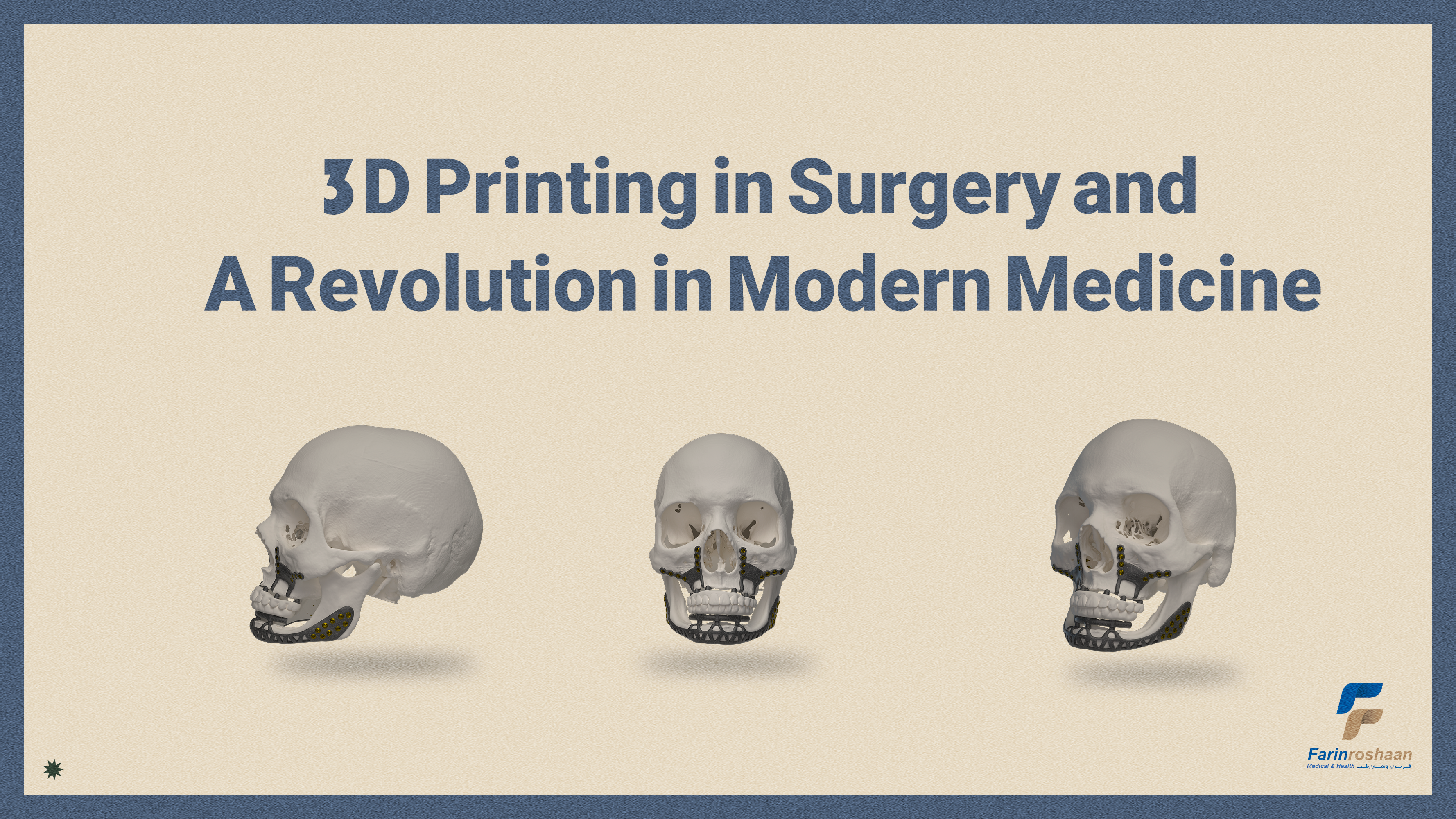 3D Printing in Surgery and A Revolution in Modern Medicine