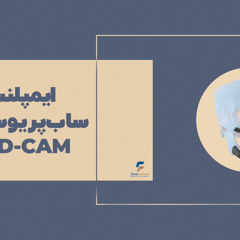 ایمپلنت ساب‌پریوستئال CAD-CAM؛ راهکاری کم‌تهاجمی برای بازسازی فک تحلیل‌رفته