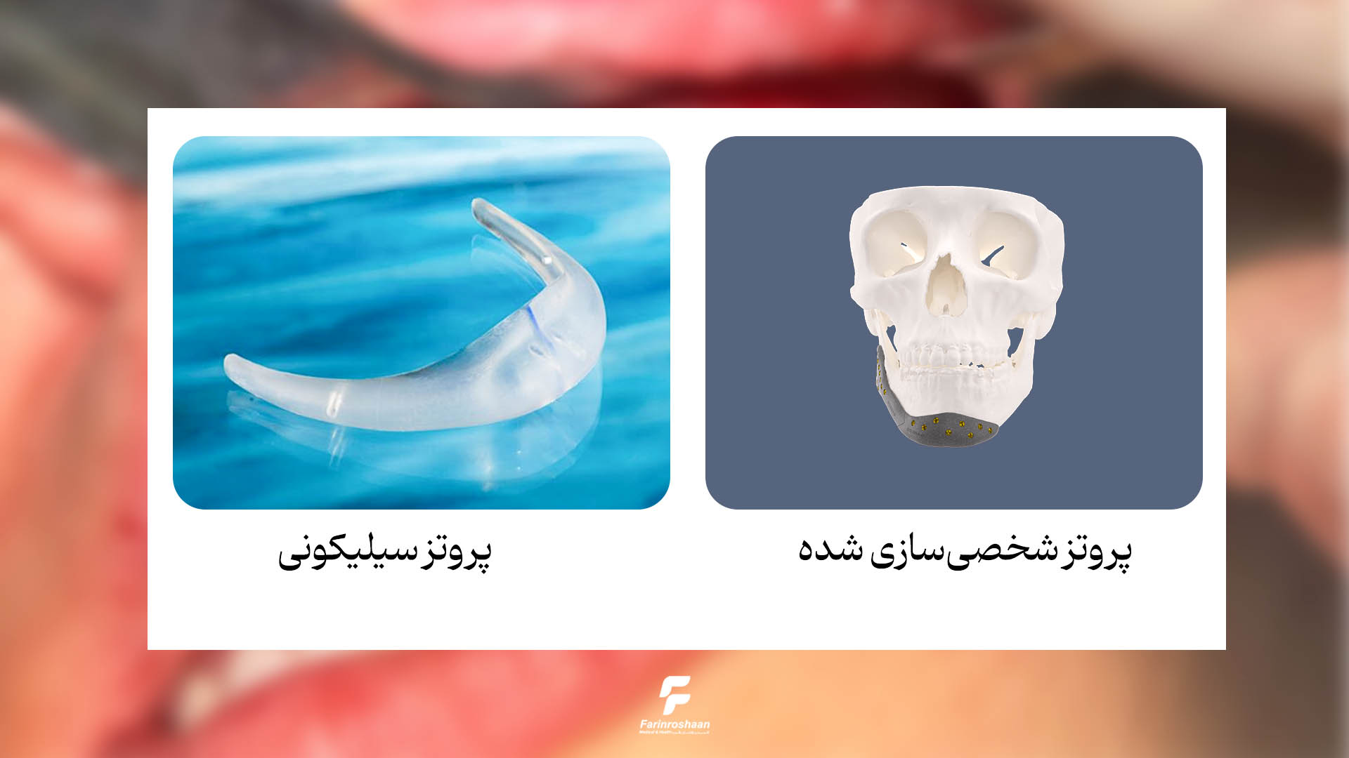 جراحی فک و صورت دیجیتال