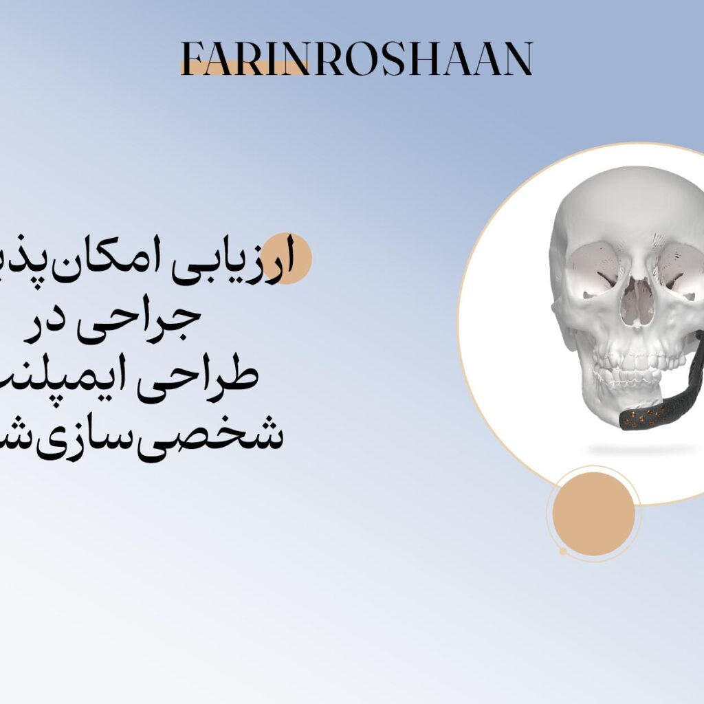 ارزیابی امکانپذیری جراحی در طراحی ایمپلنت شخصی سازی شده