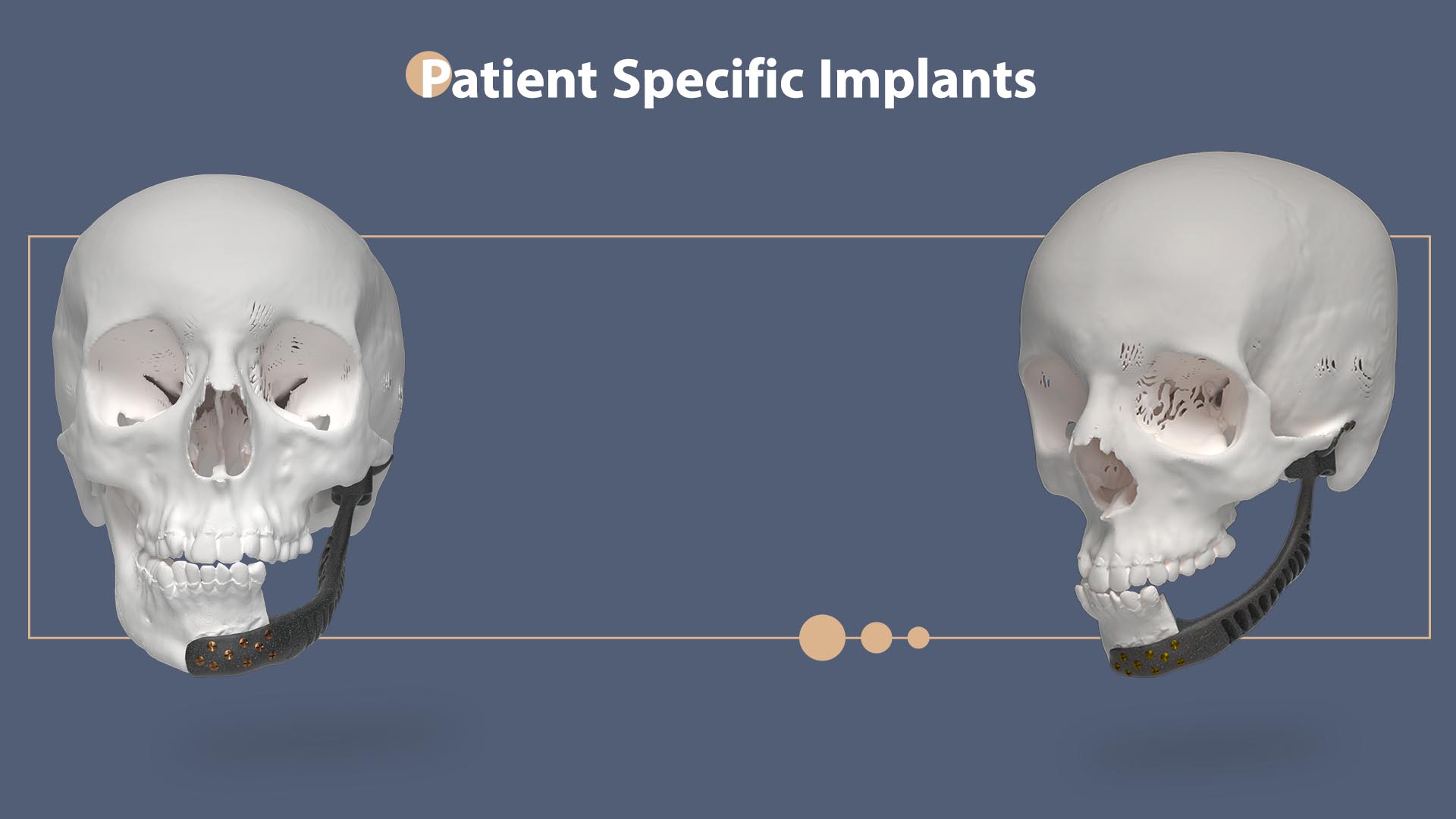 ارزیابی امکان‌پذیری جراحی در طراحی ایمپلنت شخصی‌سازی‌شده | Clinical Feasibility Gate