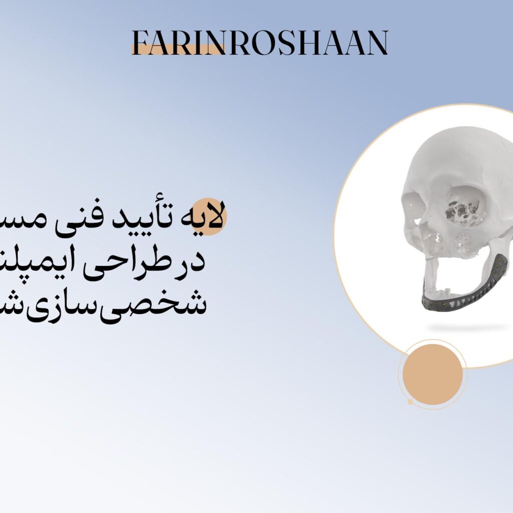 کنترل کیفیت طراحی ایمپلنت
