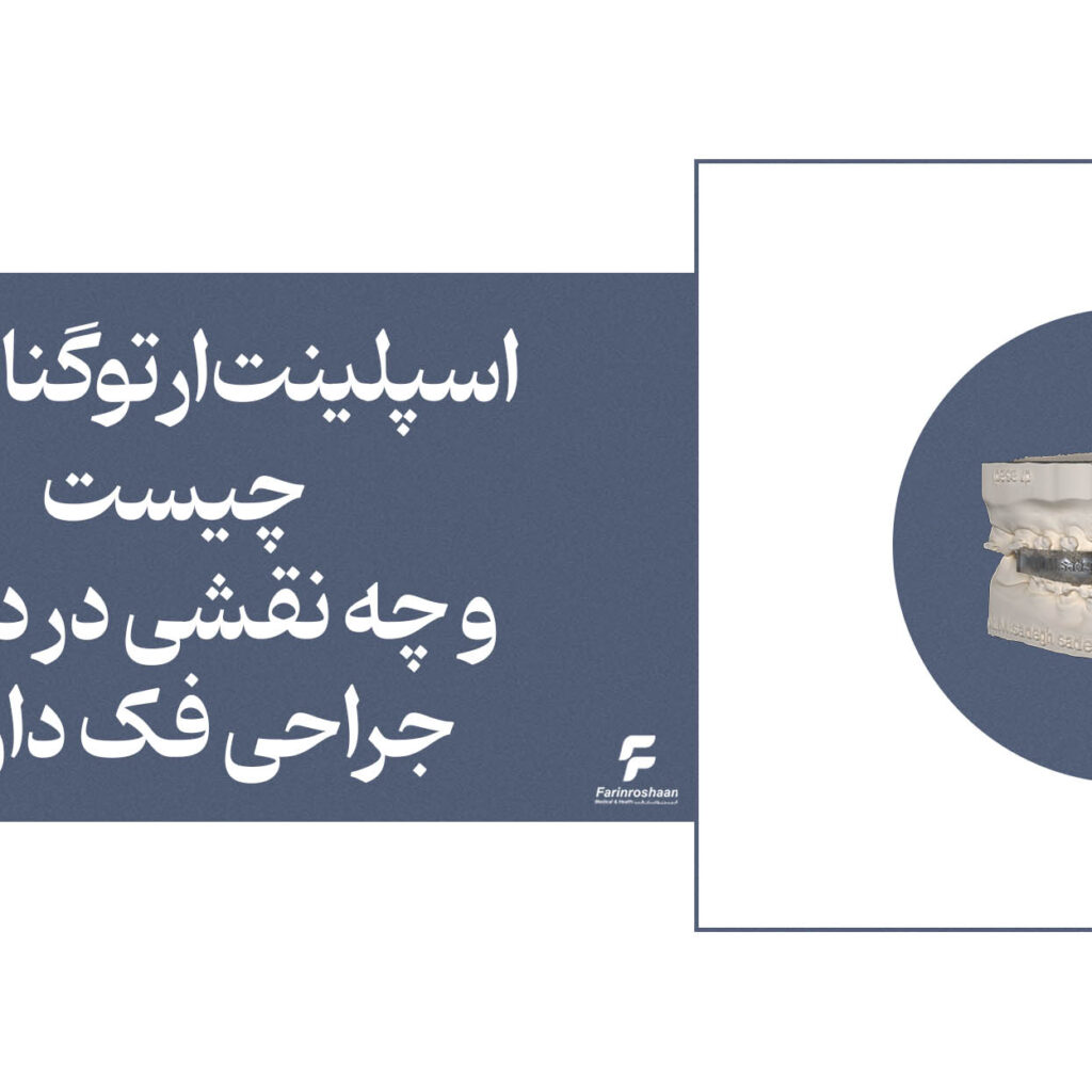 اسپلینت ارتوگناتیک
