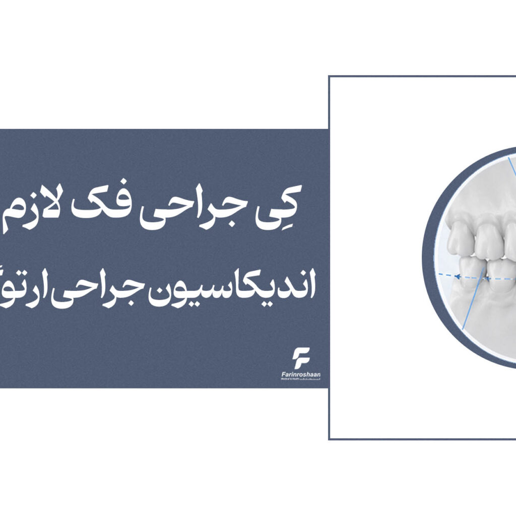 اندیکاسیون جراحی ارتوگناتیک
