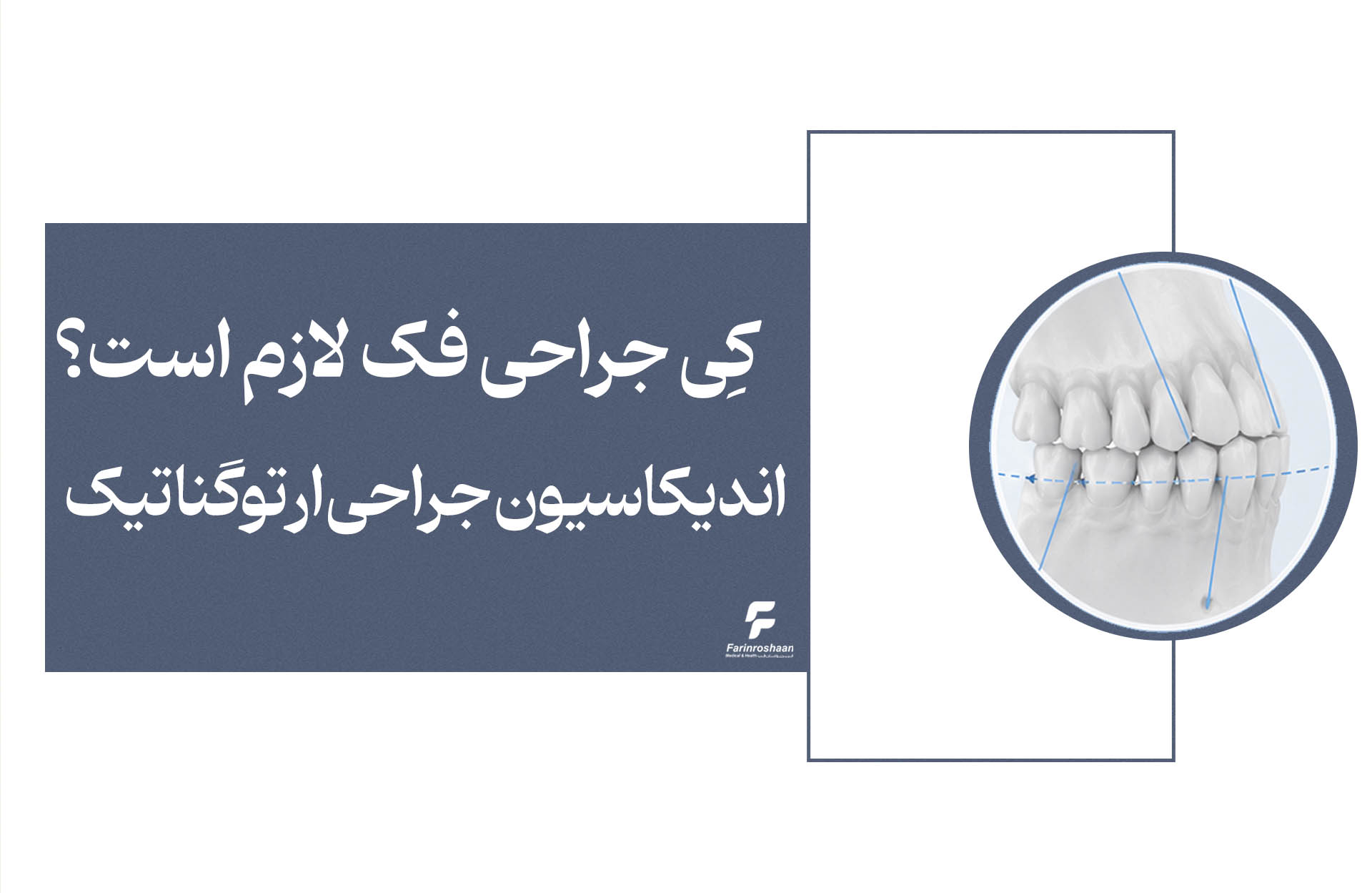 اندیکاسیون جراحی ارتوگناتیک