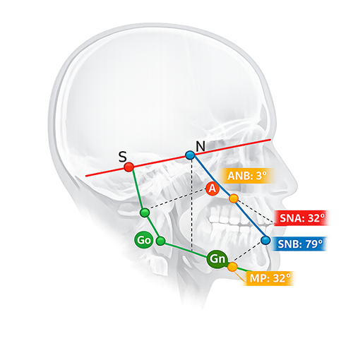 آنالیز سفالومتری دیجیتال