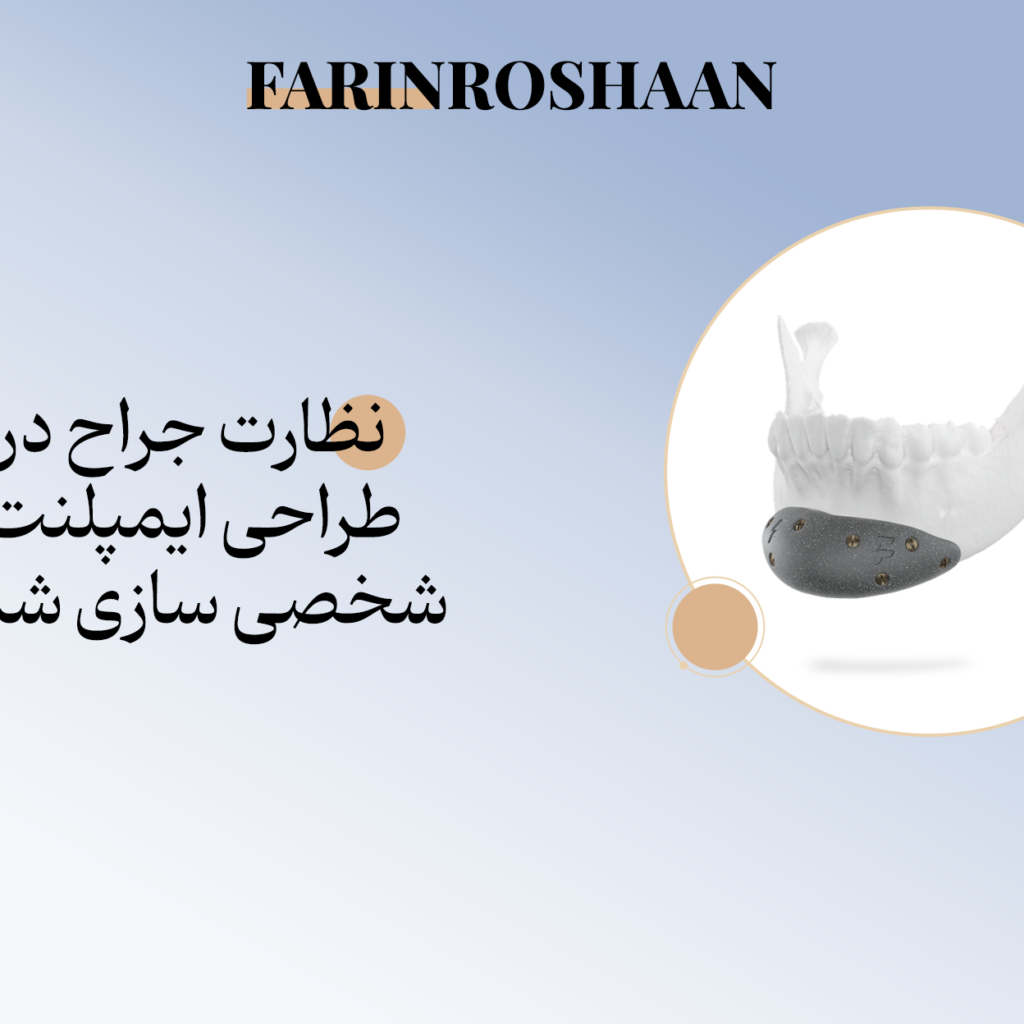 طراحی ایمپلنت شخصیسازیشده
