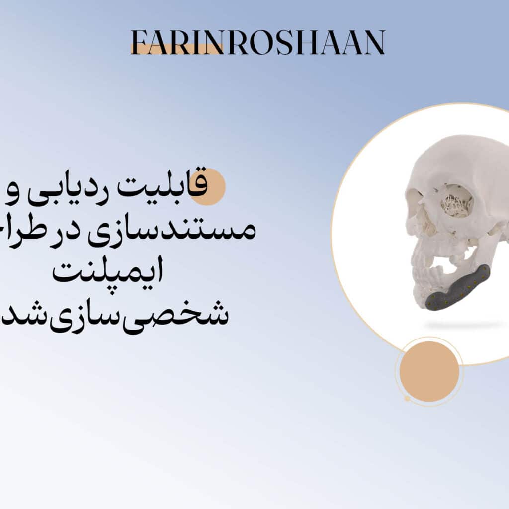 طراحی ایمپلمنت شخصی سازی شده