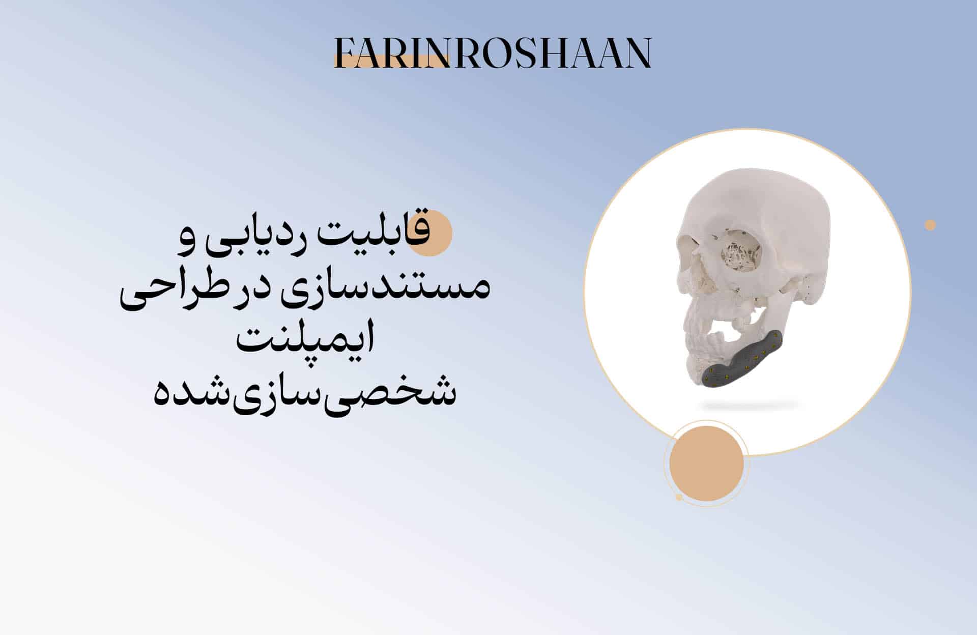 طراحی ایمپلمنت شخصی سازی شده