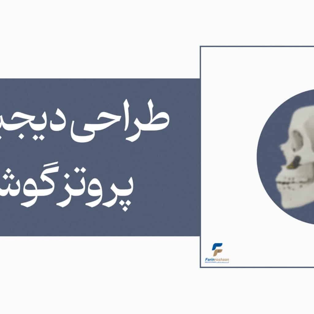 پایه تیتانیومی گوش