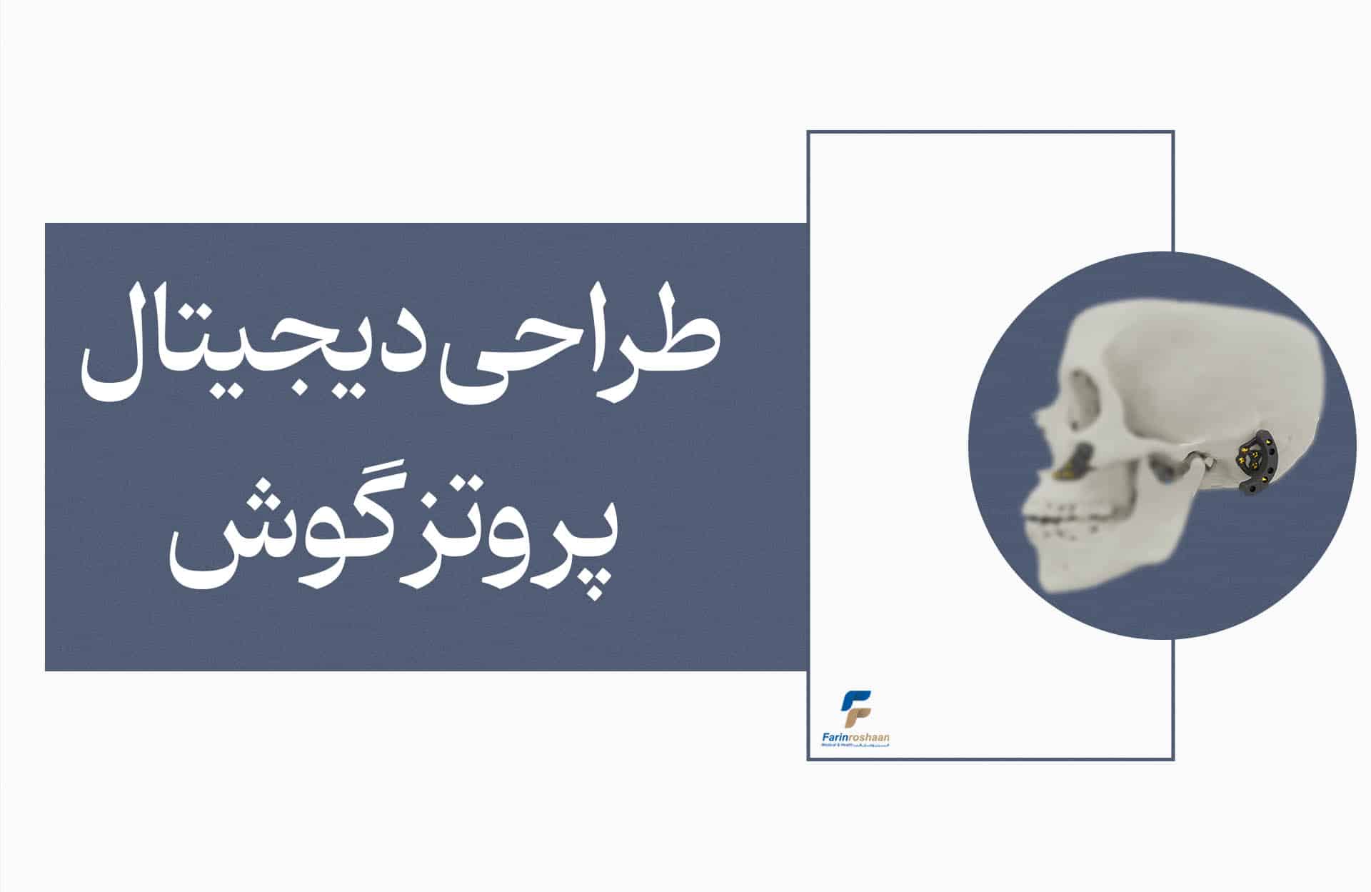 پایه تیتانیومی گوش