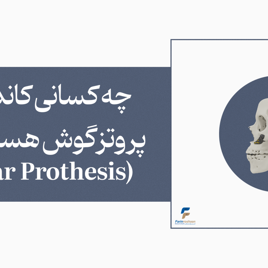 کاندید پروتز گوش