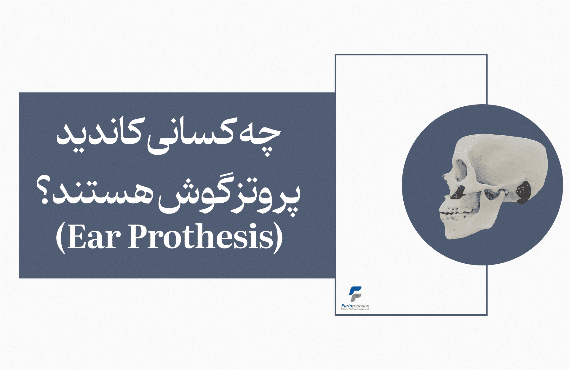 کاندید پروتز گوش