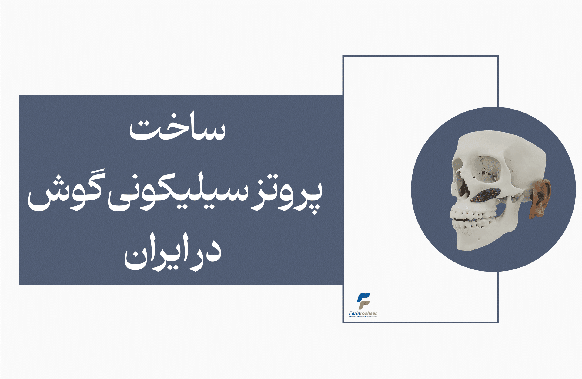 پروتز سیلیکونی گوش
