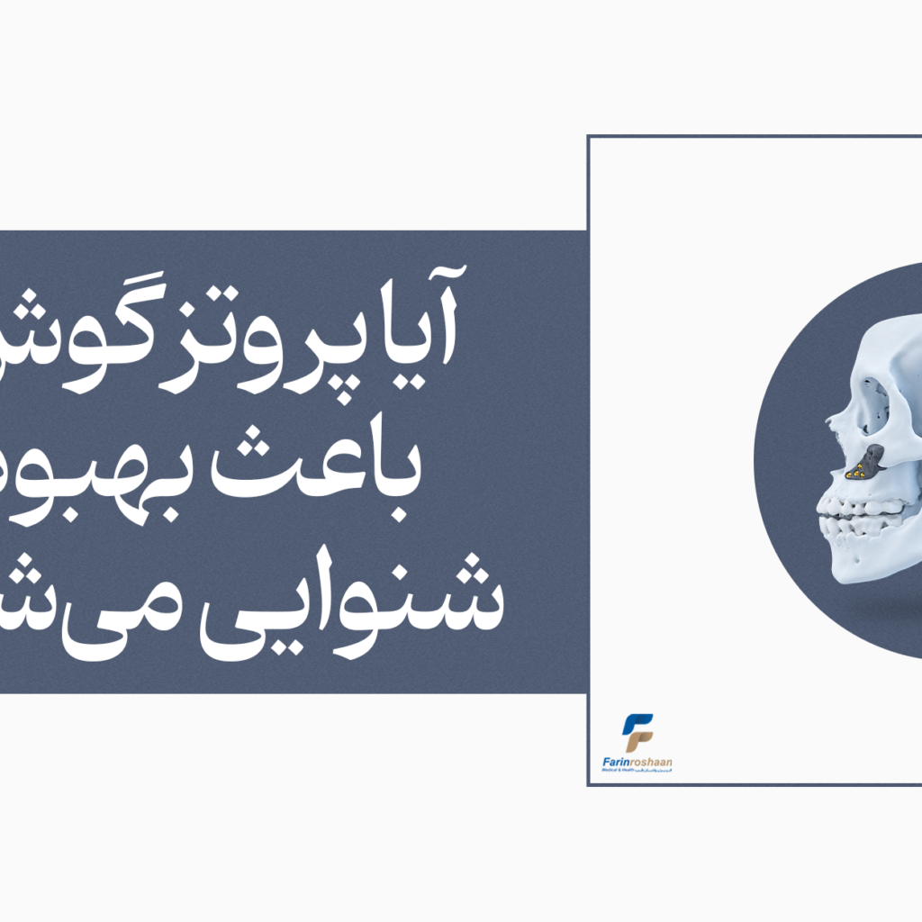 آیا پروتز گوش باعث بهبود شنوایی می‌شود
