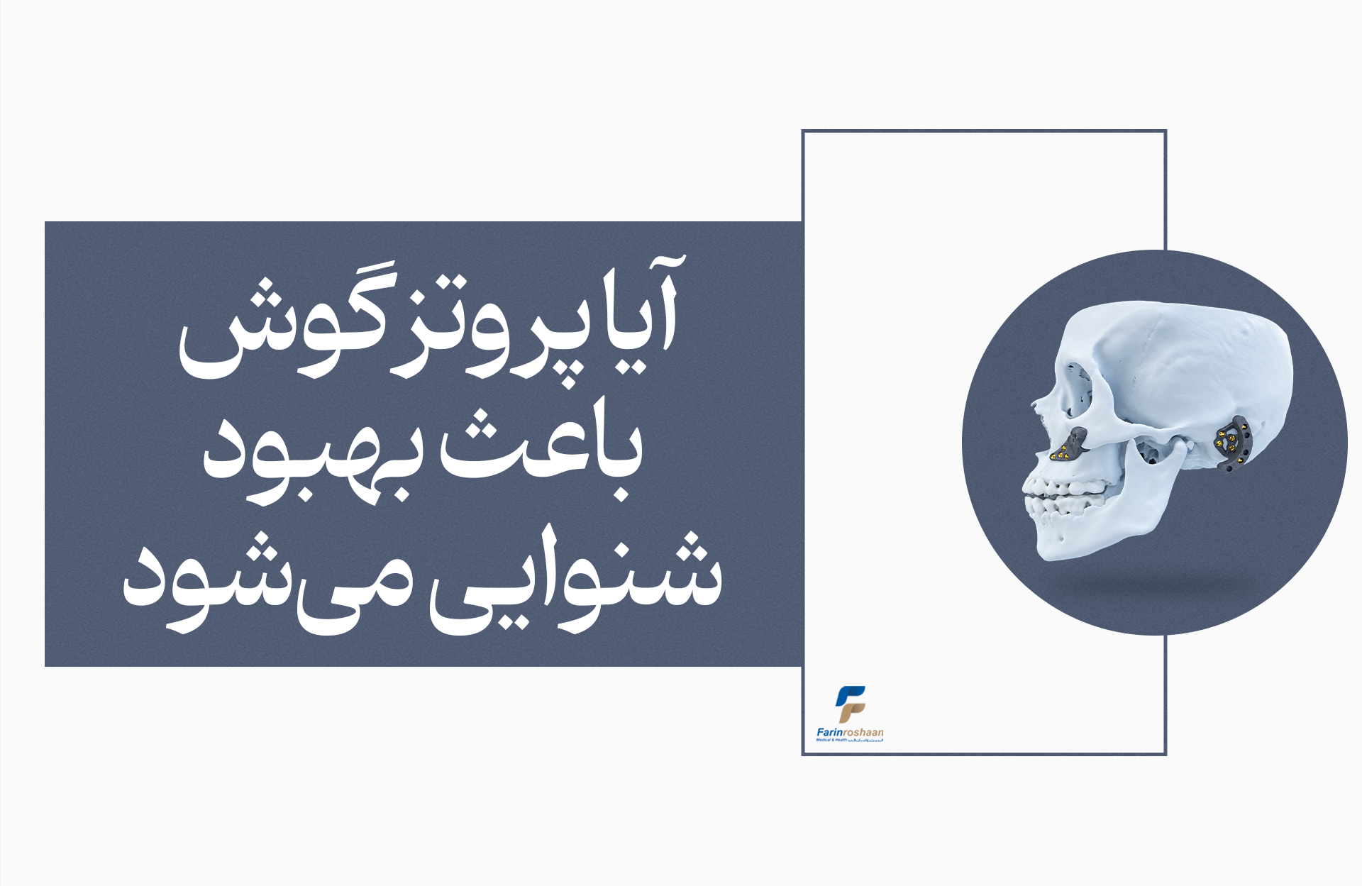 آیا پروتز گوش باعث بهبود شنوایی می‌شود