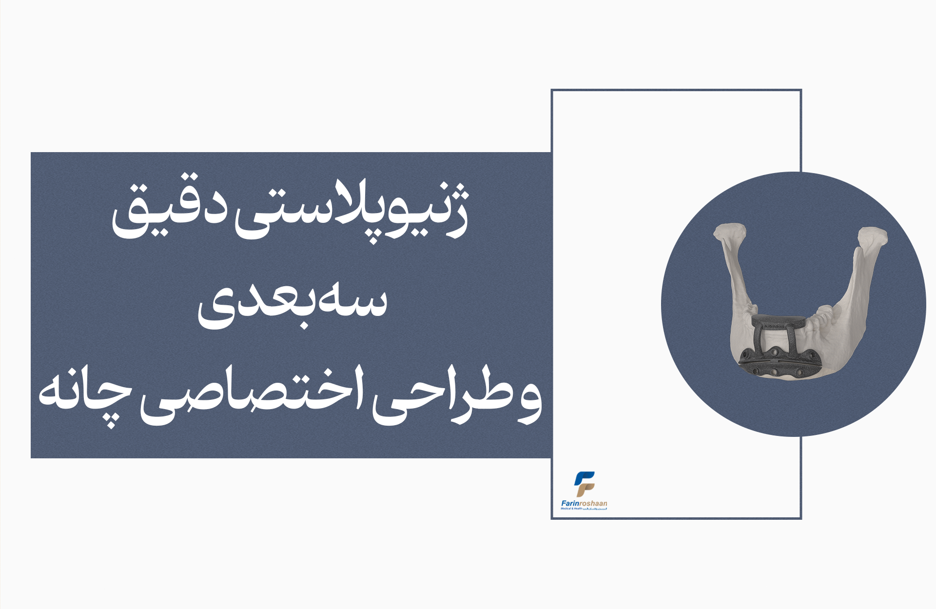 ژنیوپلاستی دقیق سه‌بعدی و طراحی اختصاصی چانه